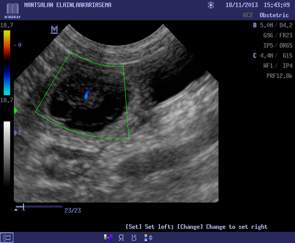Canine Ultrasound Scanning for Pregnancy Determination What you