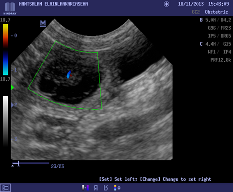 Canine Ultrasound Scanning for Pregnancy Determination: What you should know?